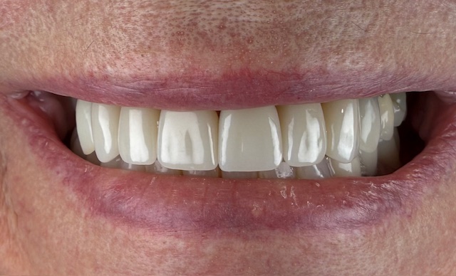 Modern Dentistry of Clarkston — photo